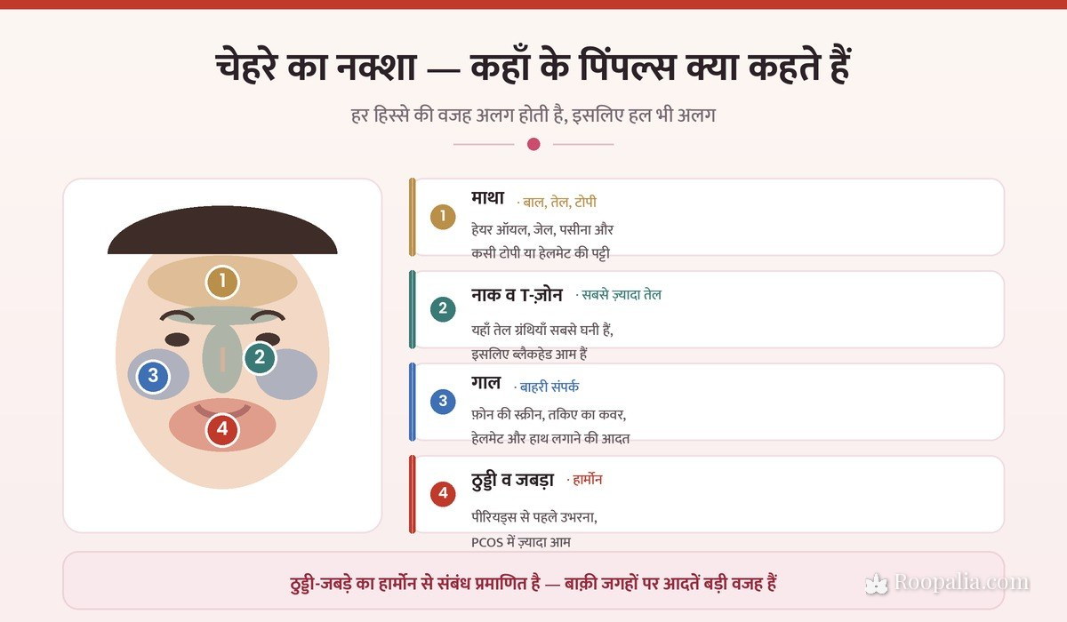 चेहरे का नक्शा — माथे, नाक, गाल और ठुड्डी पर पिंपल्स निकलने के अलग-अलग कारण